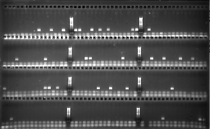 \begin{figure}\begin{center}
\epsfxsize =\linewidth
\epsfbox{bioinfo/gel1.ps}\end{center}\end{figure}